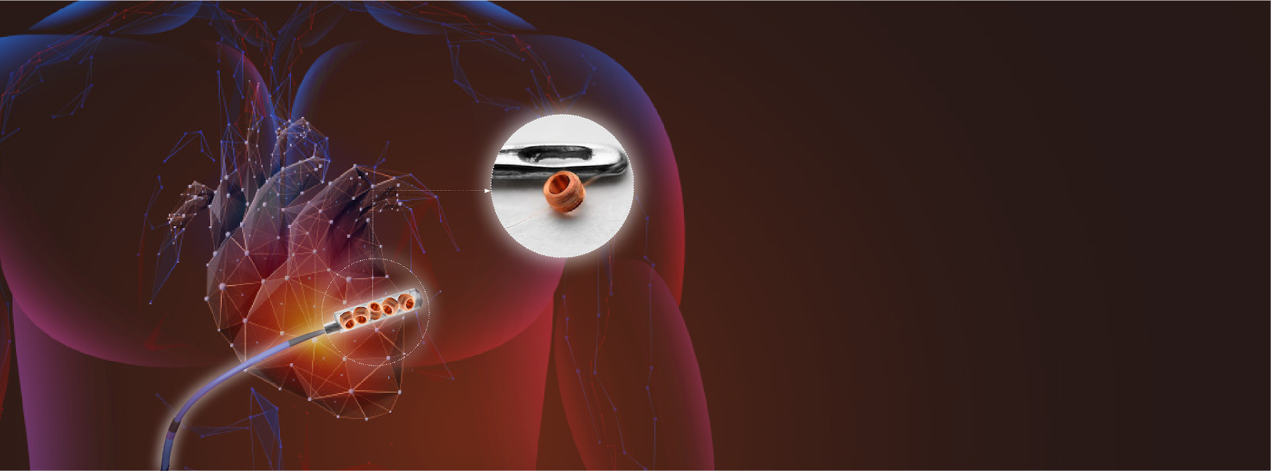 Electro Magnetic Navigation Sensor